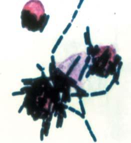 炭疽桿菌可在宿主體外生長。<br>影像來源/&nbsp; BROOKHAVEN NATIONAL LABORATORY