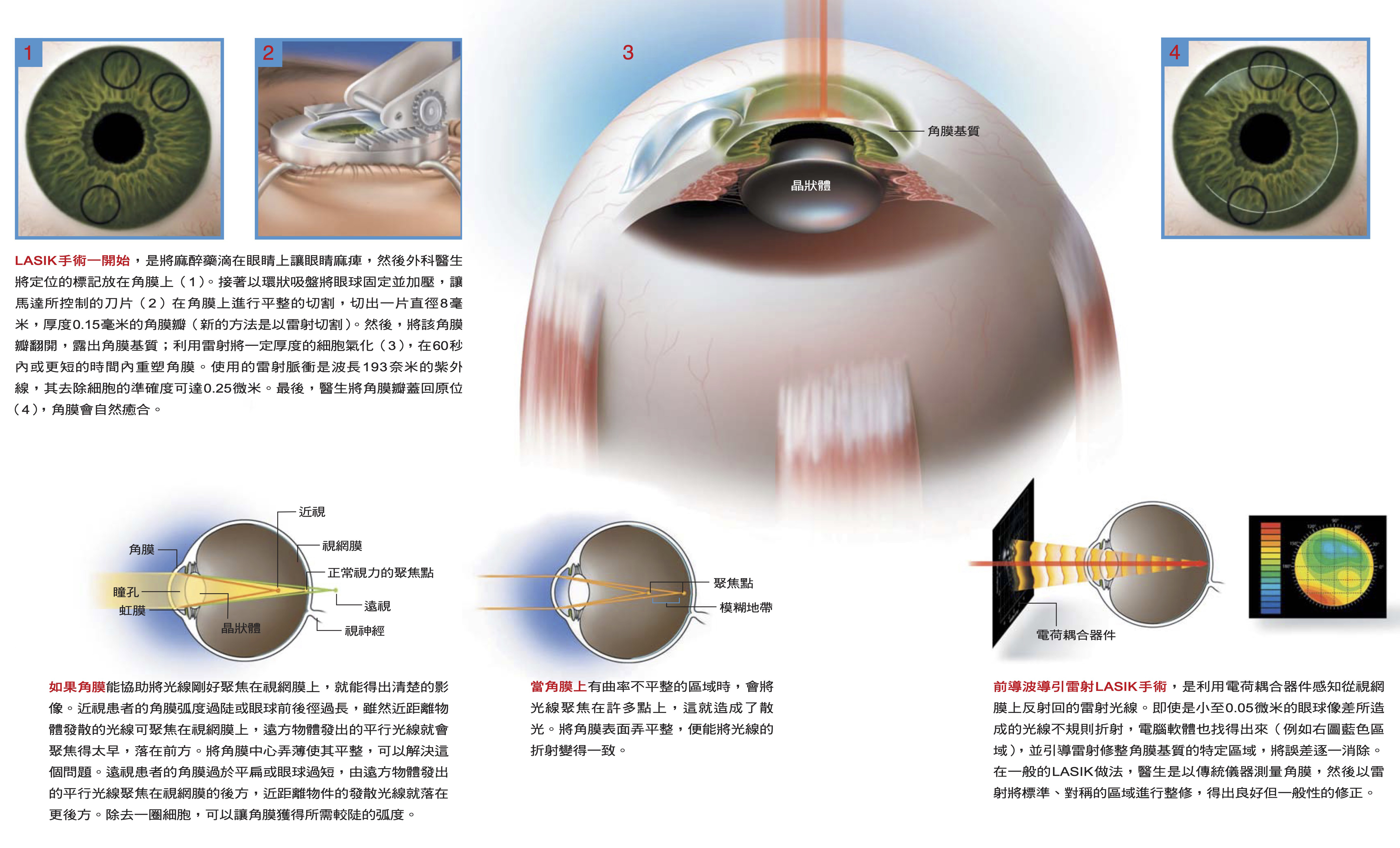 影像來源／CONNIE FUNKHOUSER BALEK Precision Graphics