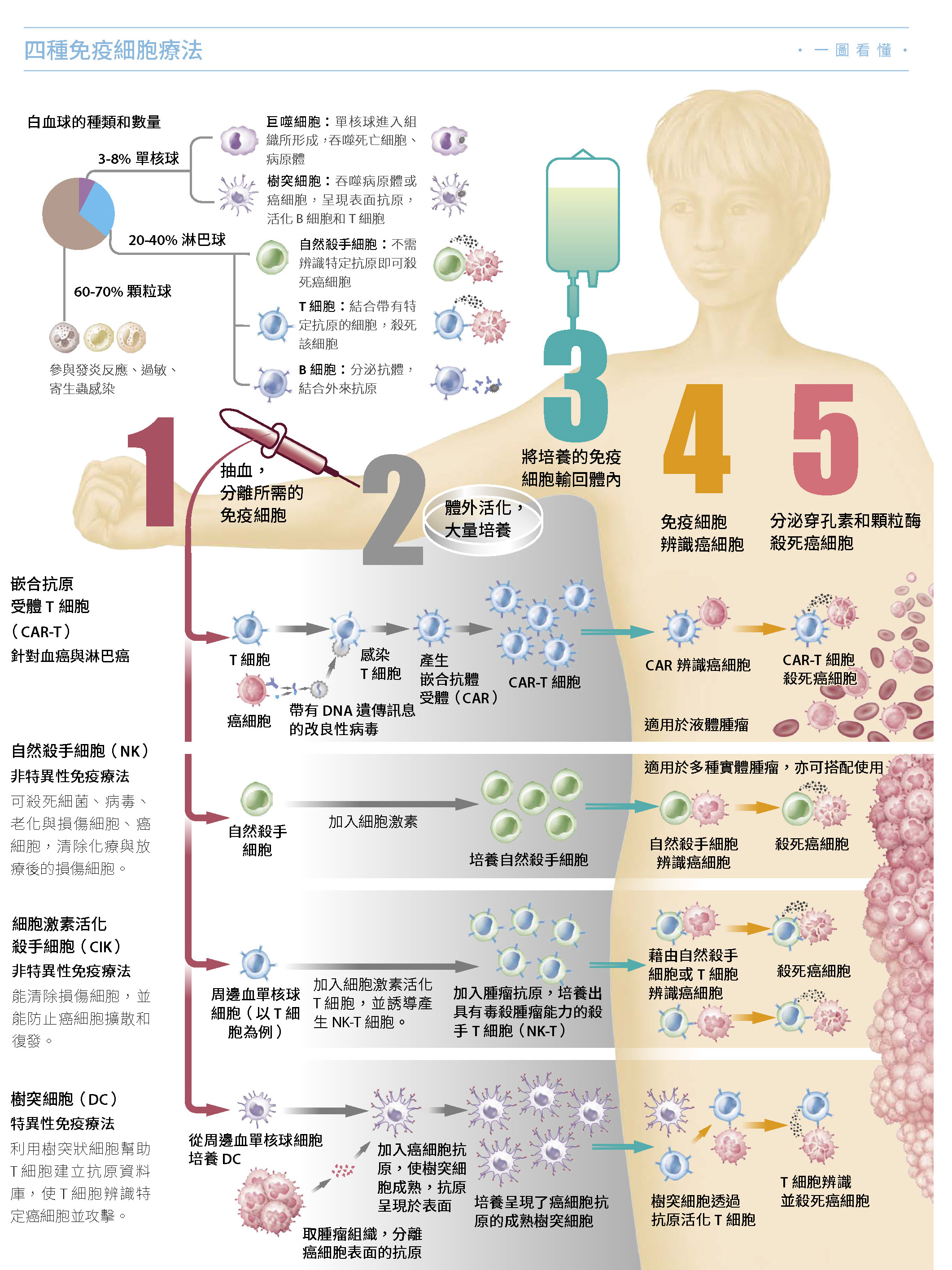利用自己的免疫大軍治療癌症｜科學人
