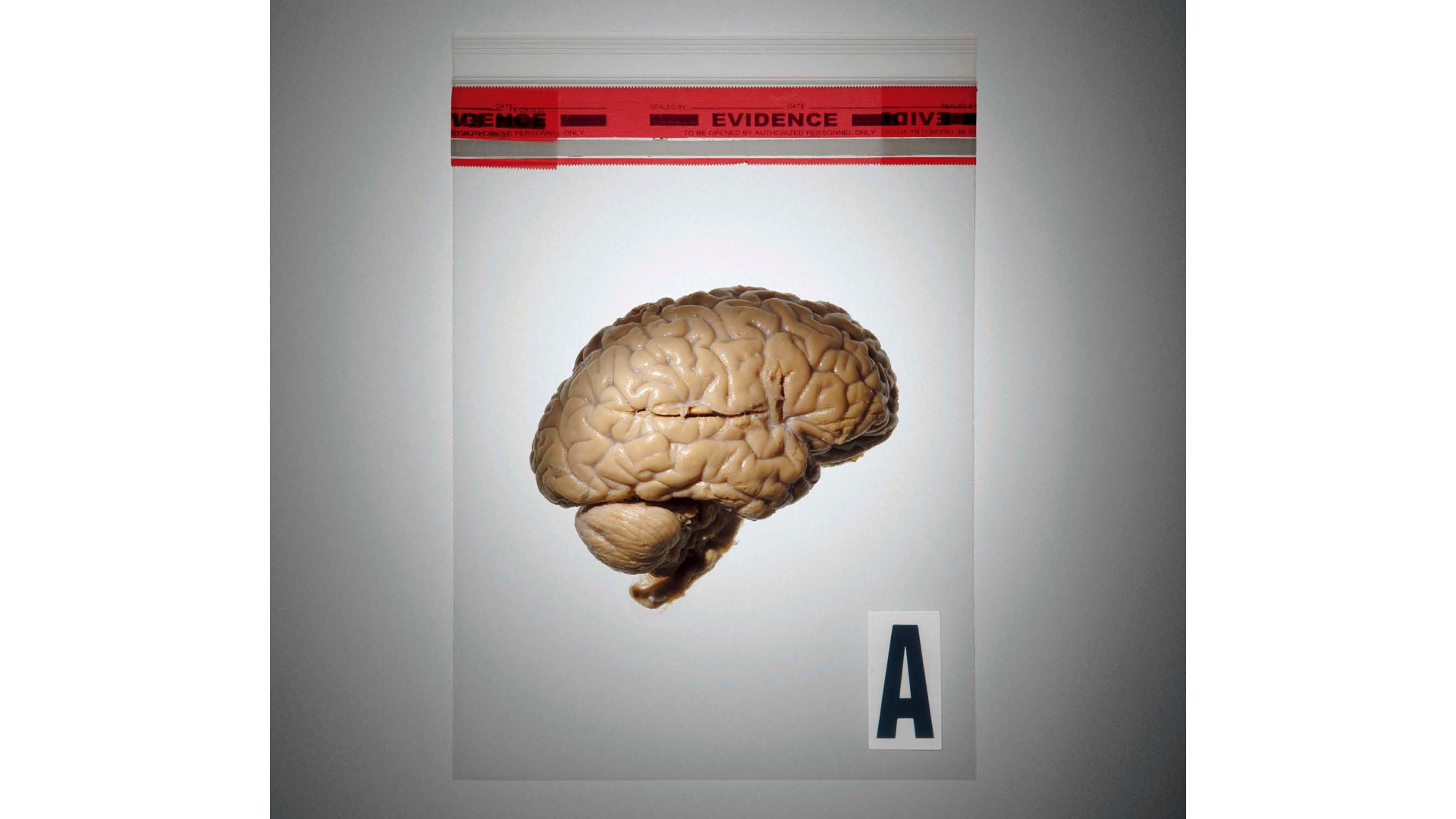 BRAIN COURTESY OF DEPARTMENT OF PATHOLOGY, COLUMBIA UNIVERSITY MEDICAL CENTER; PHOTOGRAPH BY ZACHARY ZAVISLAK
