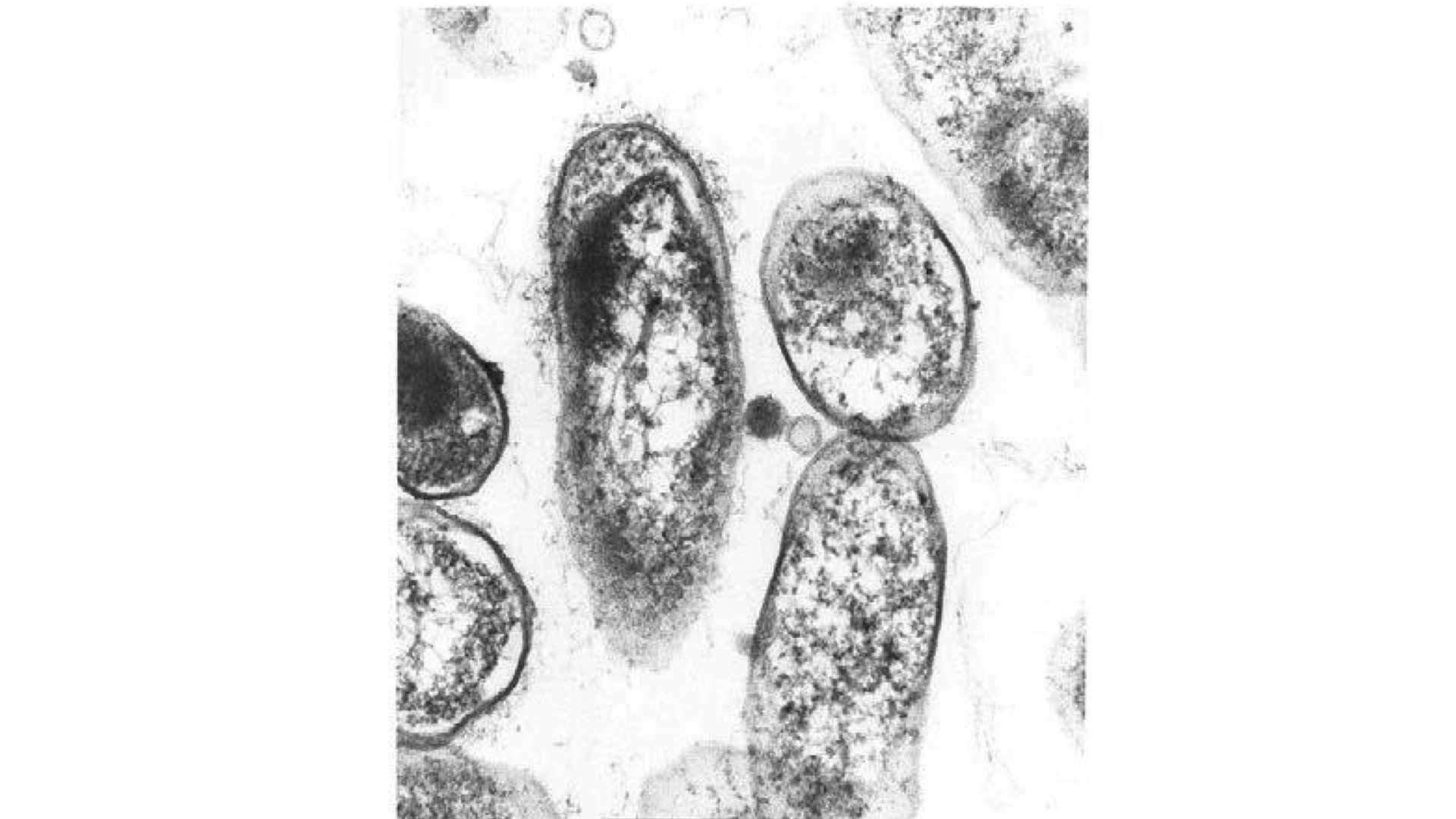 影像來源：COURTESY OF RICARDO MAGGI North Carolina State University, College of Veterinary Medicine Laboratory for Advanced Electron and Light Optical Methods
