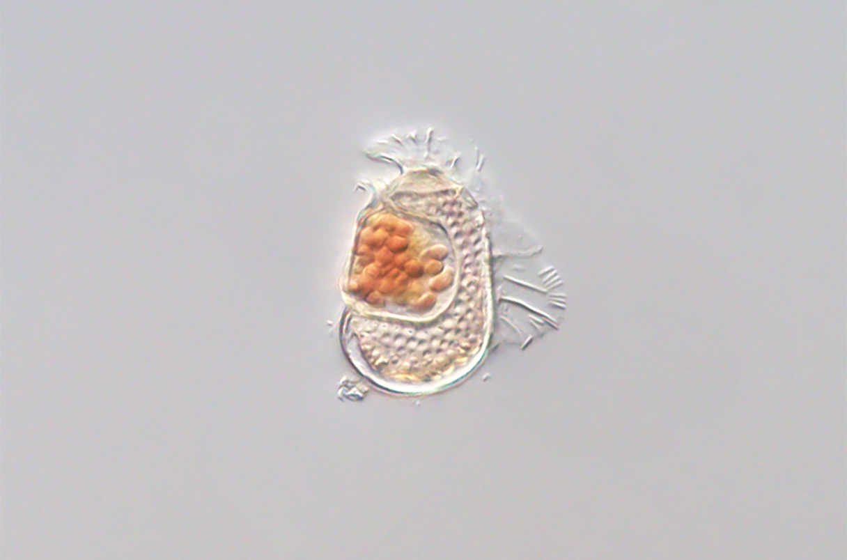 這種甲藻內部隱藏著一種微小的微生物，它對宿主的依賴程度極高，科學家認為它是已知的最像病毒的細胞生物。｜影像來源： 中山卓郎/筑波大學
