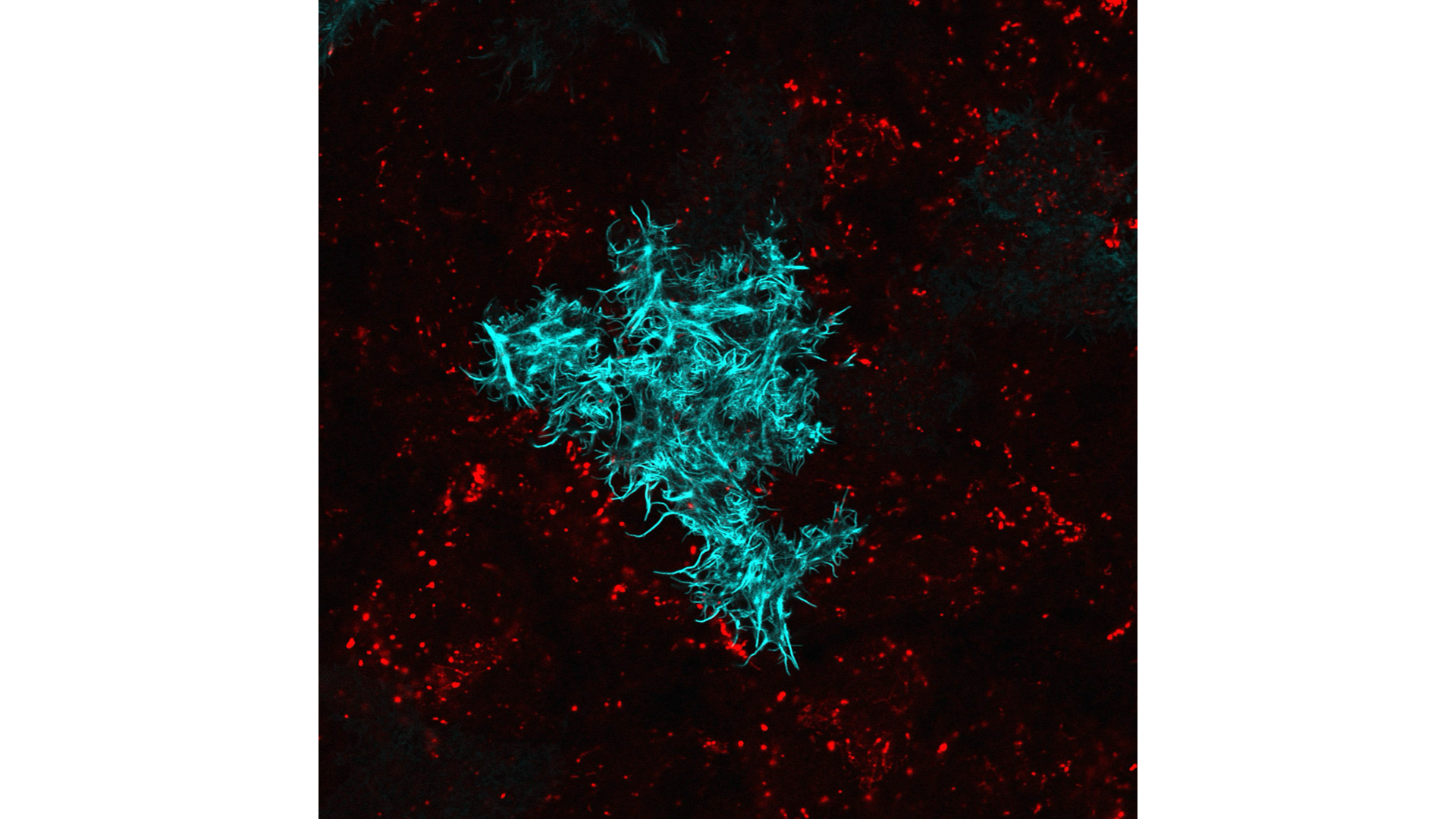 2023 Taiwan顯微攝影競賽優選作品「James P. Sullivan」，由温榮崑以共軛焦顯微鏡拍攝。