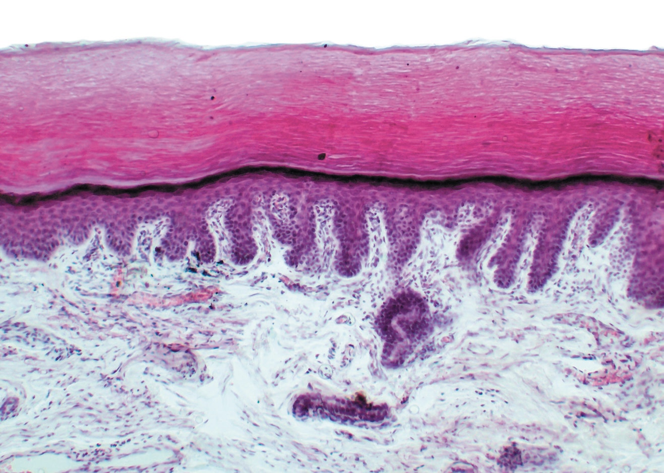 細胞不沉默：照片中的紫色部位為手指皮膚的上皮細胞。｜Yaroslav Stepaniuk/Alamy Stock Photo