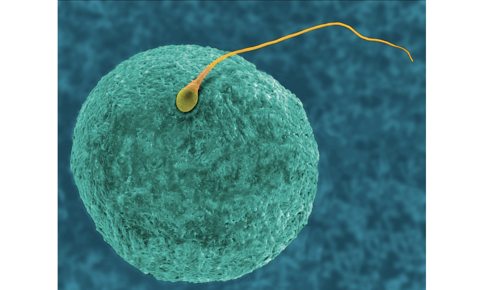 人類卵子和精子｜Dennis Kunkel Microscopy/Science Source