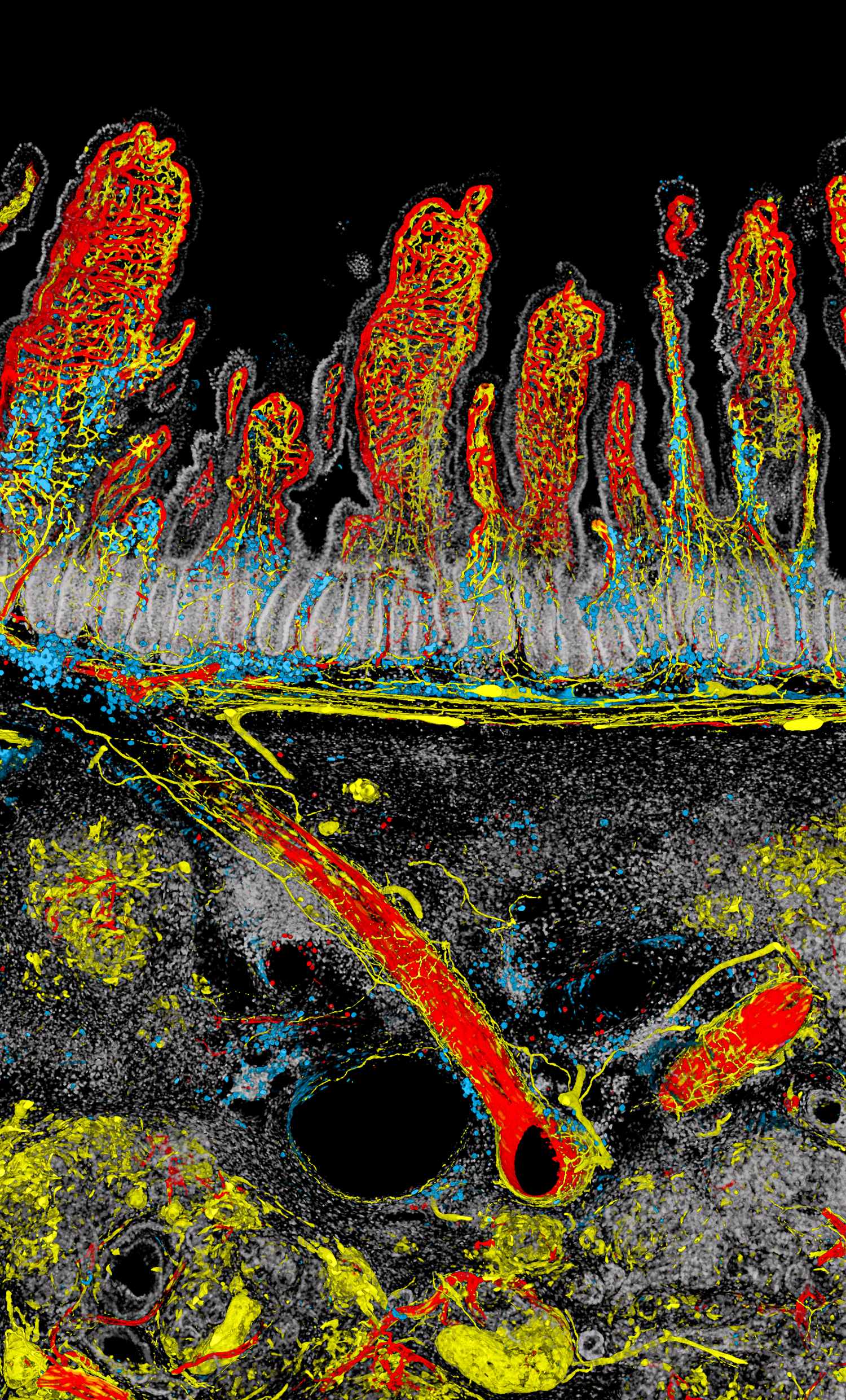 第四屆台灣顯微攝影競賽銀獎作品「劍拔弩張」的影像，由中研院基因體中心的博士後研究員簡宏任所拍攝。畫面中以腫瘤與腸道的交界處作為分割，上方為十二指腸的腸絨毛血管和神經網絡，下方則是侵襲的胰臟癌腫瘤，呈現出生命與疾病在邊界對峙的氛圍。連評審都忍不住讚嘆：「影像具有魄力與情緒渲染力，讓人直觀感受到人體對抗癌症的不適和緊張。」